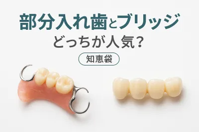 部分入れ歯とブリッジ どっち人気？【知恵袋】