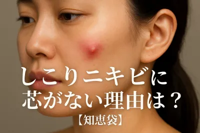 しこりニキビに芯がない理由は？【知恵袋】