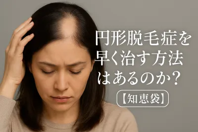 円形脱毛症を早く治す方法はあるのか？【知恵袋】