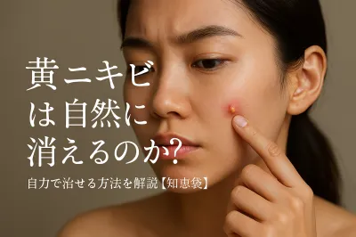 黄ニキビは自然に消えるのか？自力で治せる方法を解説【知恵袋】